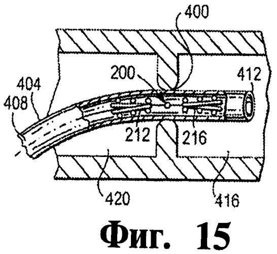 Окклюдер для чрезкожной транслюминальной процедуры (варианты), способ чрезкожного транслюминального закрытия отверстия в сердце, способ активизации васкуляризации ткани млекопитающего in vivo и способ активизации заживления места анастомоза (патент 2470611)