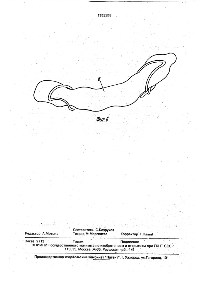Хирургическая скобка (патент 1752359)