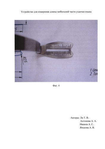 Устройство для измерения длины части уздечки языка (патент 2579279)
