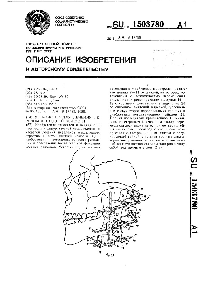 Устройство для лечения переломов нижней челюсти (патент 1503780)