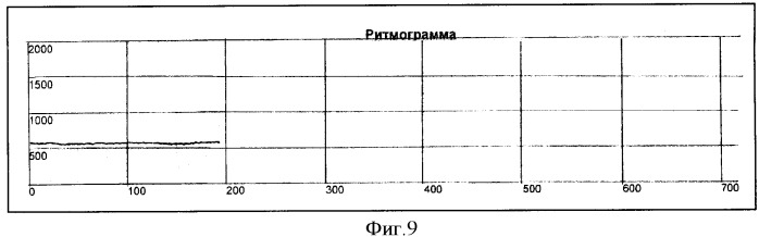 Способ определения типа демпинг-реакции при демпинг-синдроме (патент 2334456)