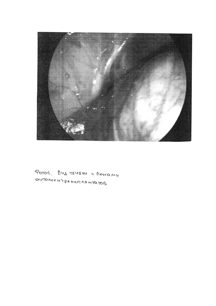 Способ экспериментального моделирования аутотрансплантации селезеночной ткани в печень (патент 2610361)