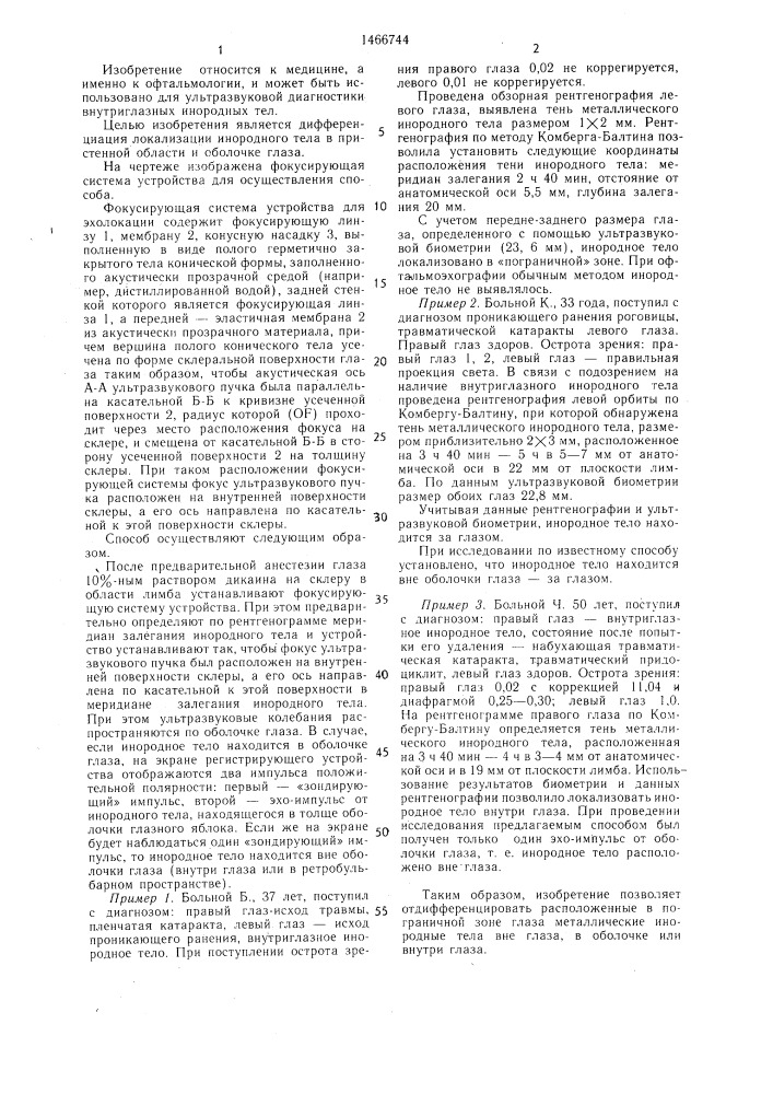 Способ определения местоположения инородных тел в пограничной зоне глаза (патент 1466744)