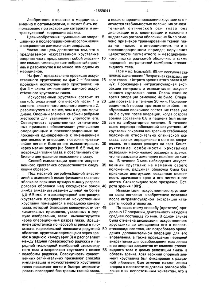 Искусственный хрусталик глаза и способ его имплантации (патент 1659041)