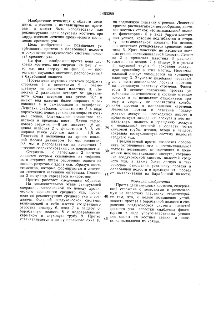 Протез цепи слуховых косточек (патент 1463280)