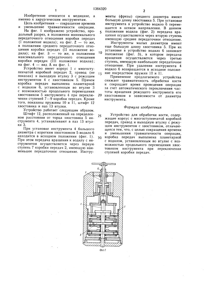 Устройство для обработки кости (патент 1364320)