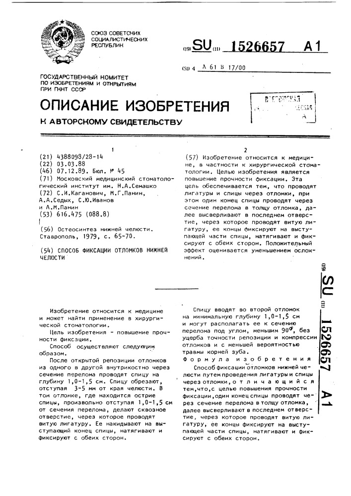 Способ фиксации отломков нижней челюсти (патент 1526657)