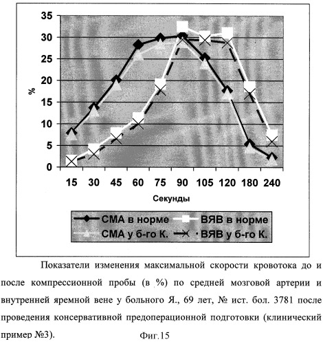 Способ диагностики ауторегуляции сосудов головного мозга (патент 2311133)