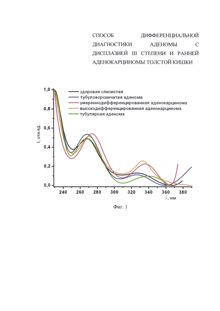 Способ дифференциальной диагностики аденомы с дисплазией iii степени и ранней аденокарциномы толстой кишки (патент 2638805)