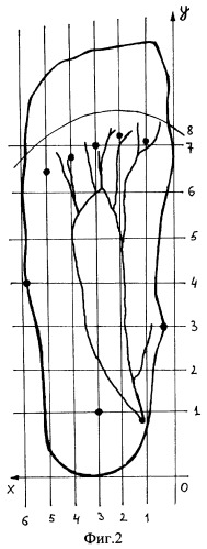 Способ определения локализации нормальных анатомических образований стопы (патент 2315563)