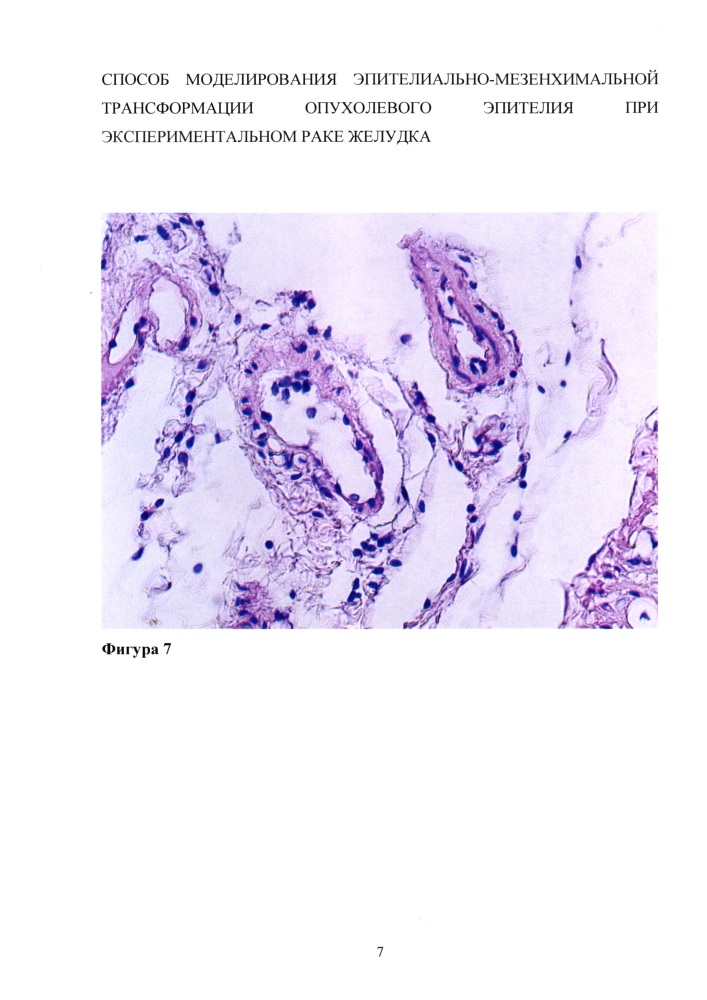 Способ моделирования эпителиально-мезенхимальной трансформации опухолевого эпителия при экспериментальном раке желудка (патент 2626717)