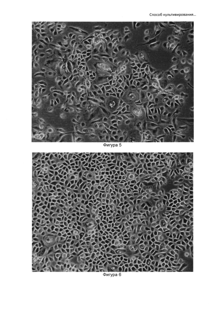 Способ культивирования клеток слюнной железы человека (патент 2631005)