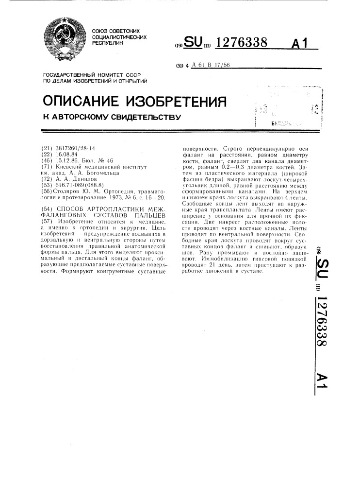 Способ артропластики межфаланговых суставов пальцев (патент 1276338)