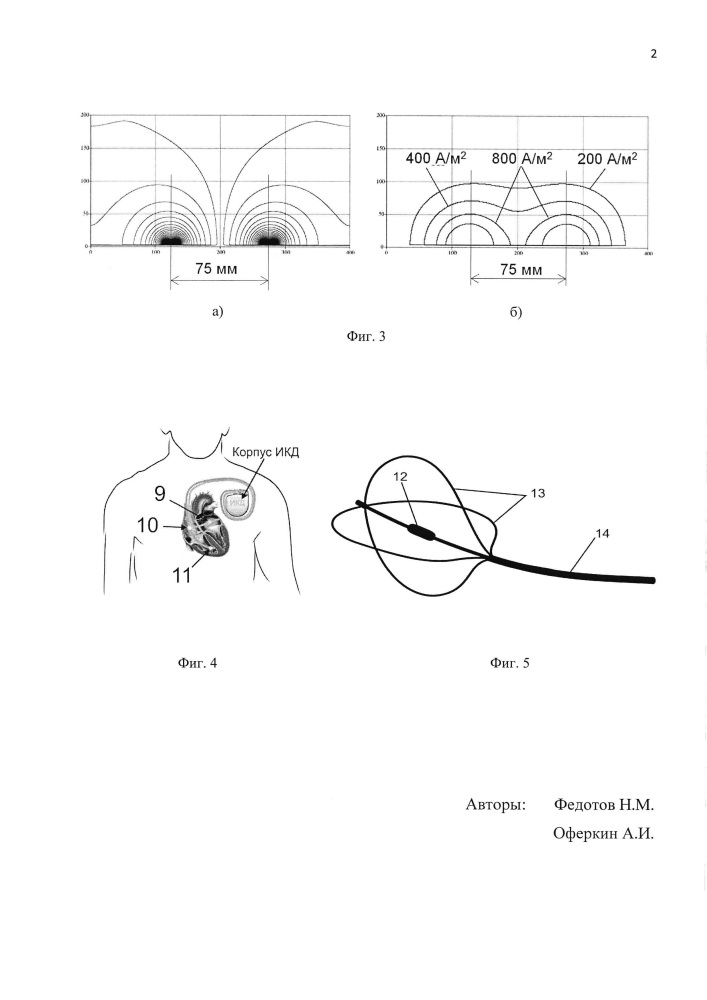 Способ формирования импульсного электрического поля для безболевой эндокардиальной кардиоверсии (патент 2609276)