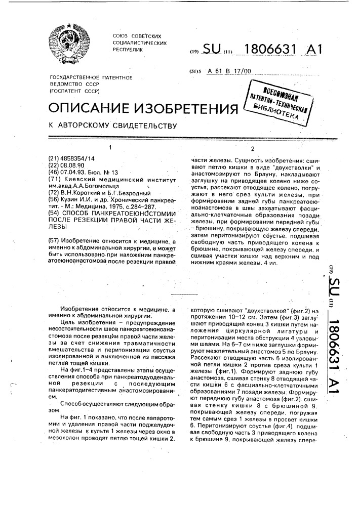 Способ панкреатоеюностомии после резекции правой части железы (патент 1806631)