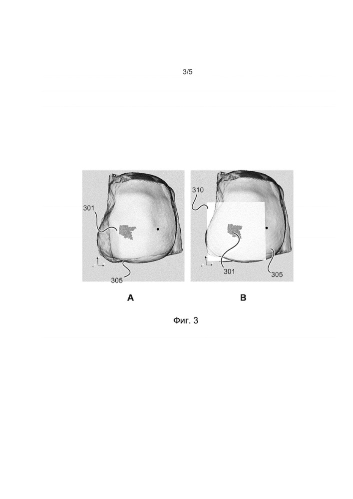 Виртуальное интерактивное определение объёмных форм (патент 2667976)