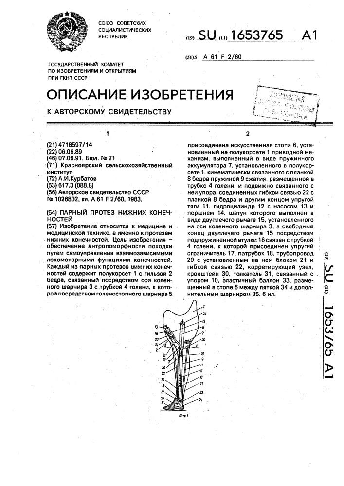 Парный протез нижних конечностей (патент 1653765)