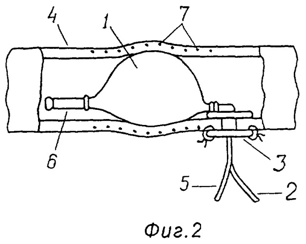 Способ перекрытия просвета кишки в эксперименте (патент 2278697)
