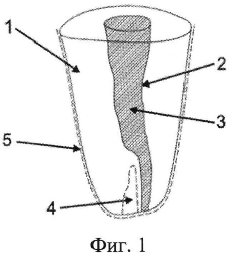 Модель корня зуба (патент 2565132)
