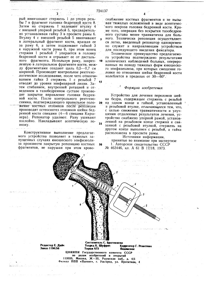 Устройство для лечения переломов шейки бедра (патент 724137)