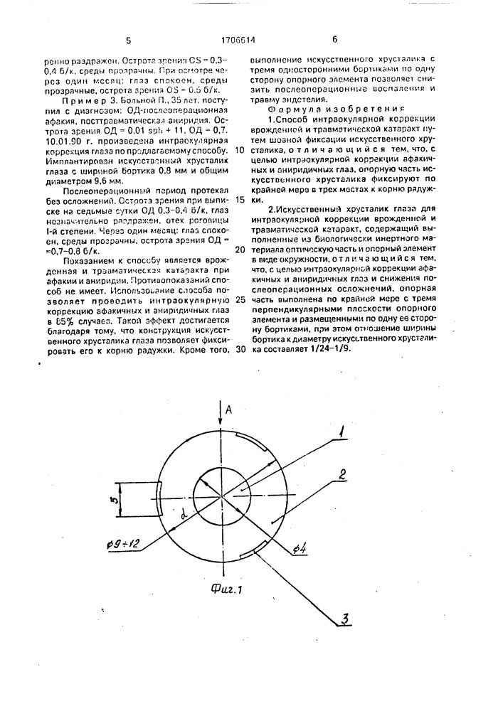 Способ интраокулярной коррекции врожденной и травматической катаракты и искусственный хрусталик глаза для его осуществления (патент 1706614)