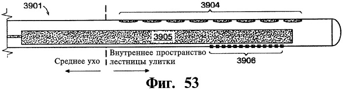 Имплантируемое устройство и способ доставки текучего лекарственного препарата в ткань (патент 2423154)