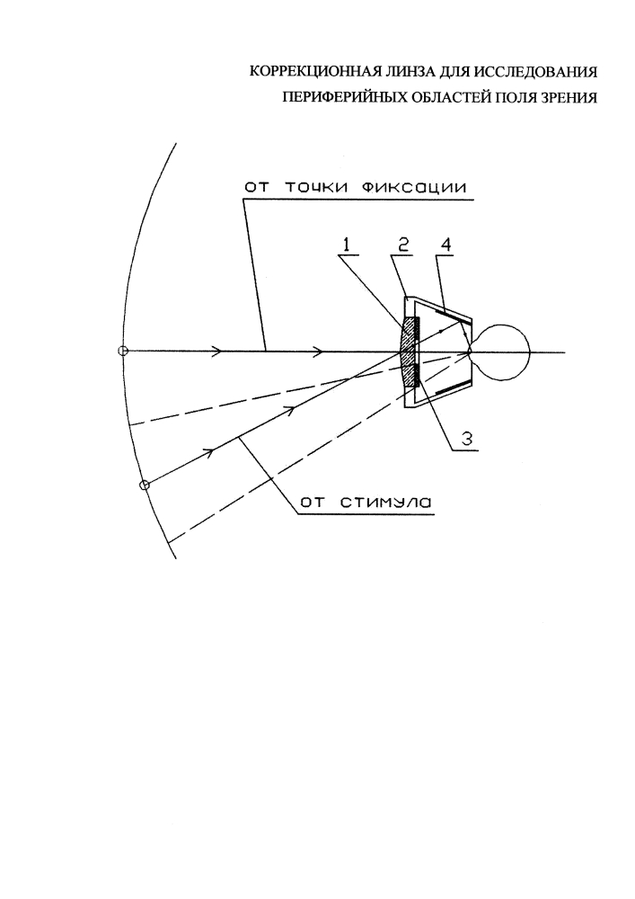 Коррекционная линза для исследования периферийных областей поля зрения (патент 2629248)