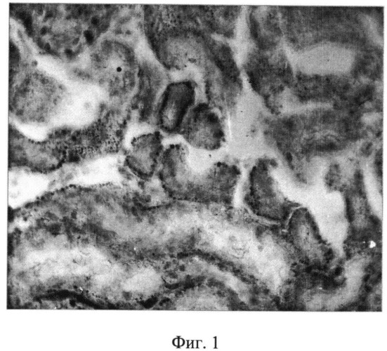 Лекарственное средство с нефропротекторным действием и способ его получения (патент 2535129)