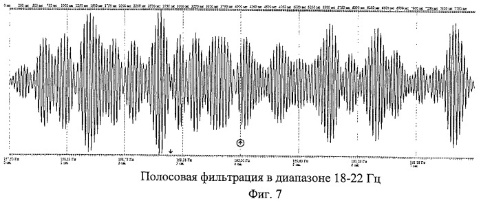 Способ определения синхронизации и десинхронизации биоэлектрической активности мозга (патент 2454172)