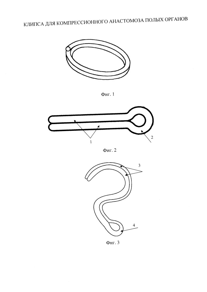 Клипса для компрессионного анастомоза полых органов (патент 2664188)