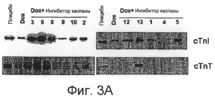 Способы выявления сердечных нарушений (патент 2498309)