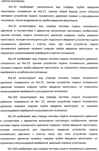 Способ лечения путем подкожной подачи пониженного давления с использованием разделения с помощью воздушного баллона (патент 2405588)