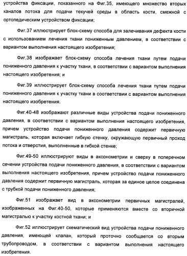 Устройство для лечения путем подкожной подачи пониженного давления с использованием текучей магистрали и связанный с ним способ (патент 2405459)