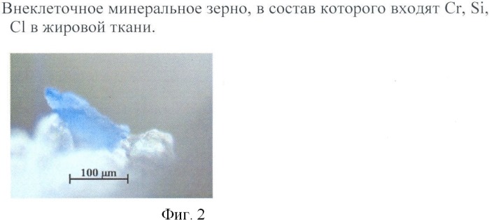 Способ выделения минеральных зерен из жировой ткани (патент 2421994)