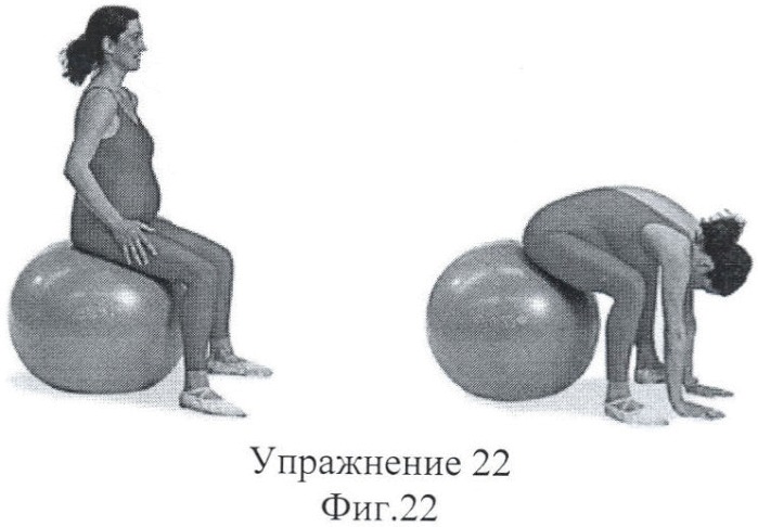 Способ подготовки к родам и послеродовому периоду беременных женщин групп риска на санаторном этапе (патент 2389464)