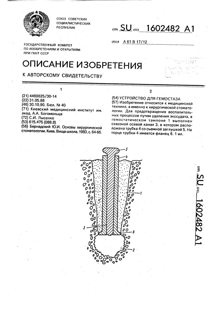 Устройство для гемостаза (патент 1602482)