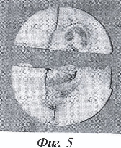 Способ изготовления протеза ушной раковины и разборный штамп для осуществления способа (патент 2421188)