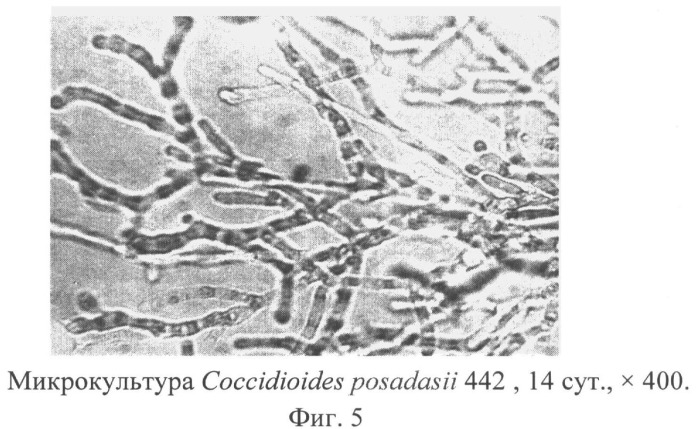 Способ приготовления живых препаратов микроскопических грибов рода coccidioides для световой микроскопии (патент 2496863)