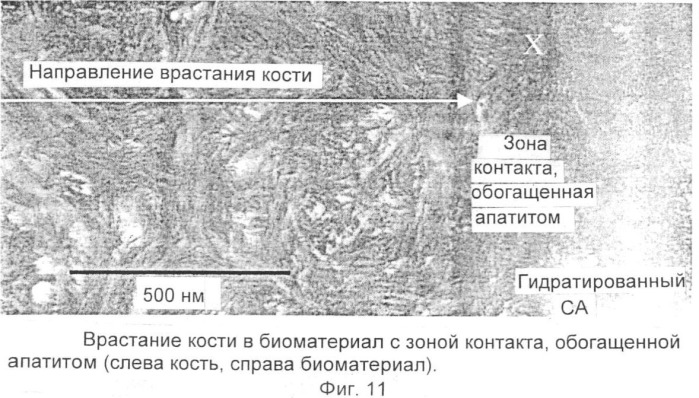 Композиция стоматологического пломбировочного материала или материала имплантата и порошкообразный материал, жидкость для гидратации, материал имплантата и способ достижения связывания (патент 2332201)