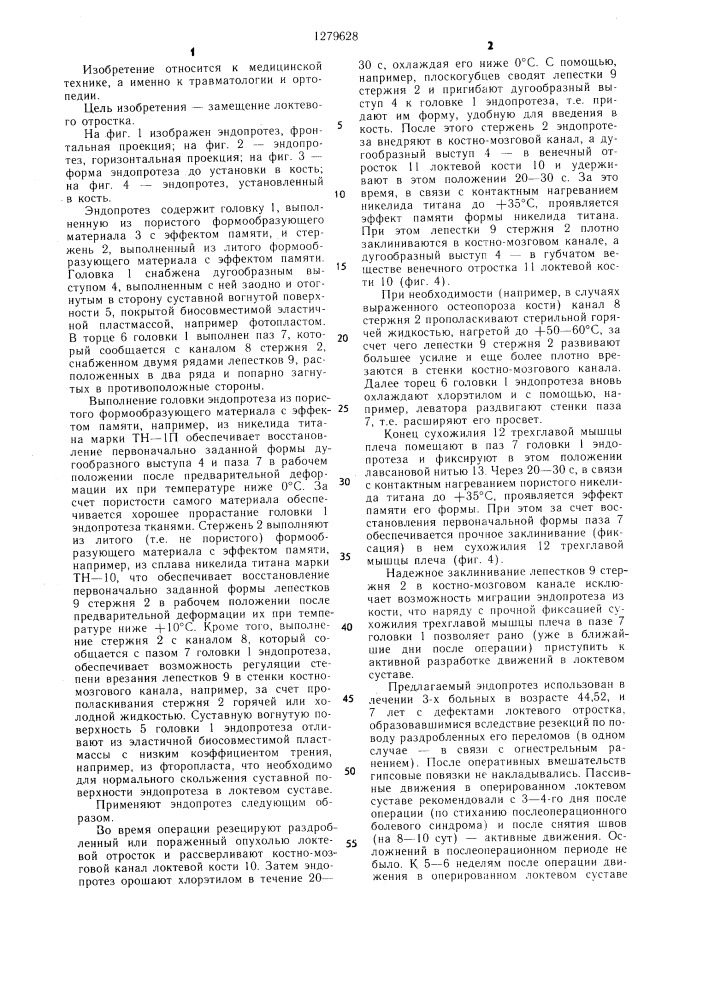 Эндопротез (патент 1279628)
