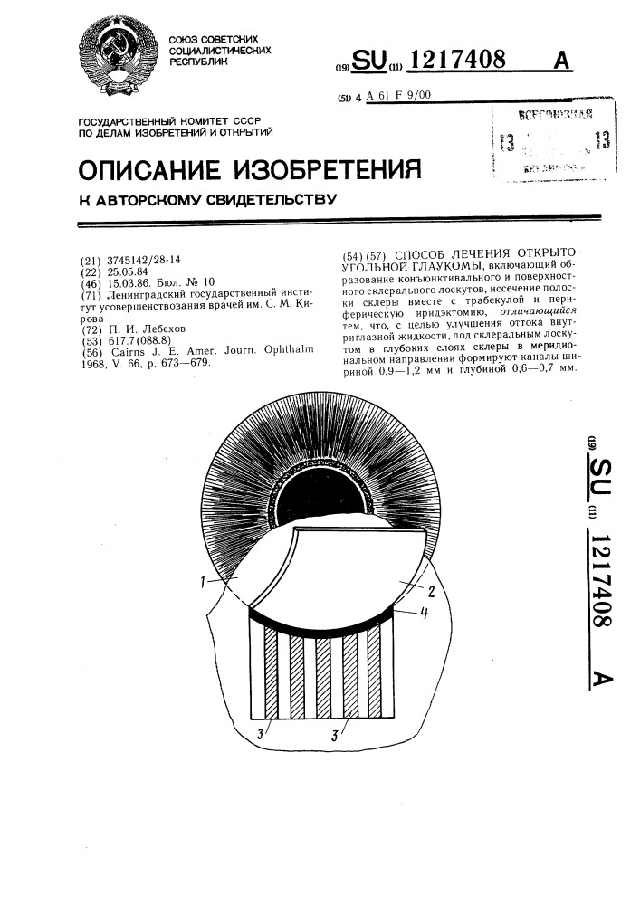 Способ лечения открытоугольной глаукомы (патент 1217408)