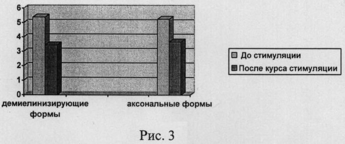 Способ лечения нарушений чувствительности при синдроме гийена-барре (патент 2477114)