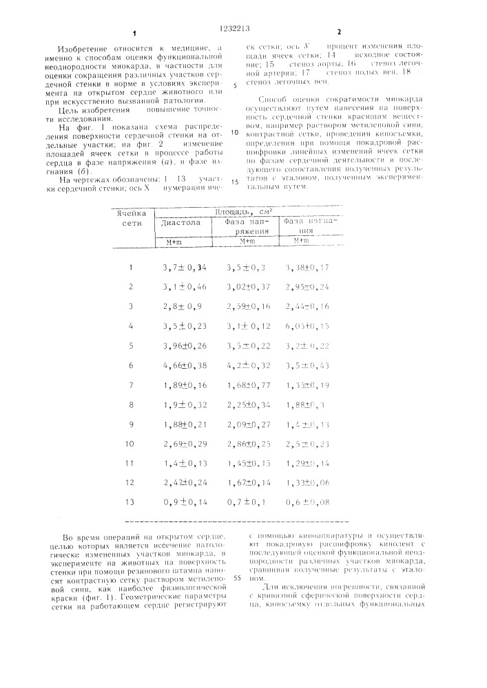 Способ оценки сократимости миокарда (патент 1232213)