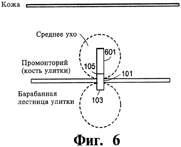 Имплантируемое устройство и способ доставки текучего лекарственного препарата в ткань (патент 2423154)