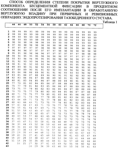 Способ определения степени покрытия вертлужного компонента бесцементной фиксации в процентном соотношении после его имплантации в обработанную вертлужную впадину при первичных и ревизионных операциях эндопротезирования тазобедренного сустава (патент 2412646)