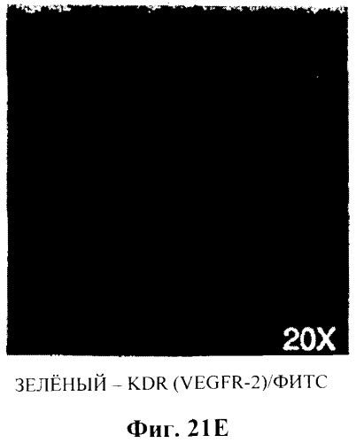 Захват эндотелиальных клеток-предшественников элюирующим лекарственные средства имплантируемым медицинским устройством (патент 2400256)