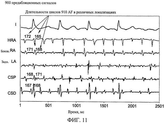 Способы, система и устройство для обнаружения, диагностики и лечения нарушений биологического ритма (патент 2556974)