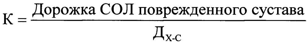 Способ оценки взаимодействия дефектов суставных поверхностей плечевого сустава при планировании хирургического лечения передней нестабильности (патент 2661717)