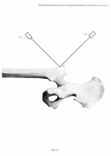 Навигационная система для эндопротезирования тазобедренного сустава (патент 2592129)