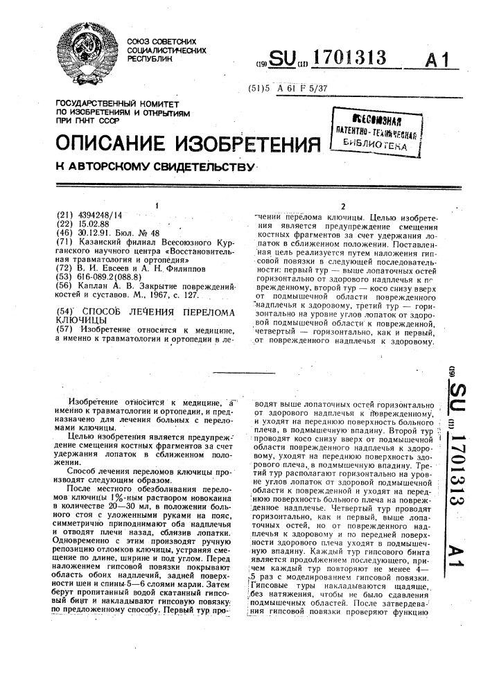 Способ лечения перелома ключицы (патент 1701313)